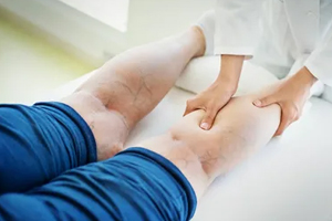 Vì sao phụ nữ dễ bị giãn tĩnh mạch chân?